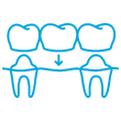 dental bridge icon